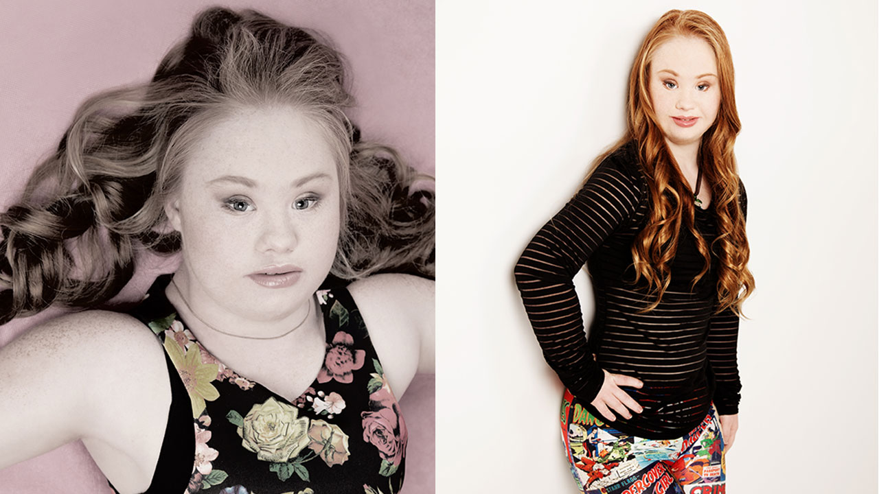 Madeline Stuart Teen With Down Sydrome Hopes Raise Awareness Through Modeling Career