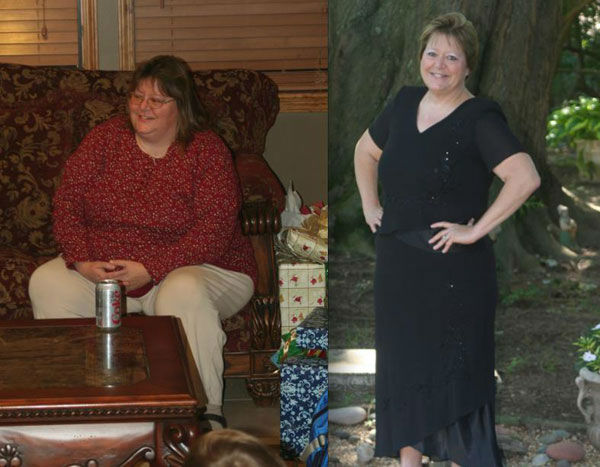 Before and after photo of Kathleen Riser's weight loss journey <span class=meta>(Facebook, Kathleen Riser)</span>