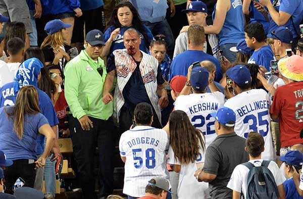 <div class="meta image-caption"><div class="origin-logo origin-image none"><span>none</span></div><span class="caption-text">A fan with a bloodied face is led away by security at Dodger Stadium on Monday, June 26, 2017. (Stephen Carr &#47; Daily News &#47; SCNG)</span></div>