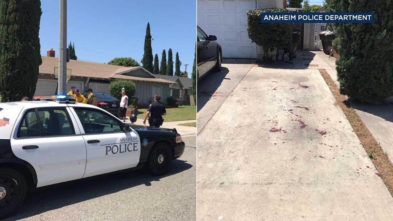4 in Critical Condition After Family Dispute Leads to Stabbing in Anaheim 4 in Critical Condition After Family Dispute Leads to Stabbing in Anaheim