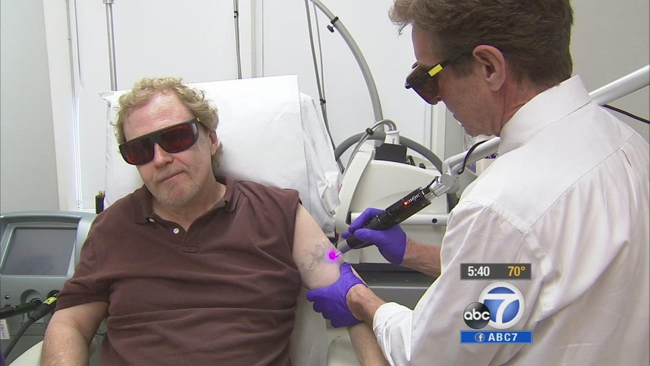 new procedure delivers improved tattoo removal abc7 com new procedure delivers improved tattoo removal abc7 com