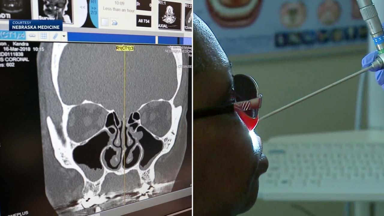 Woman known as 'Half Ton Killer' shares weight loss journey