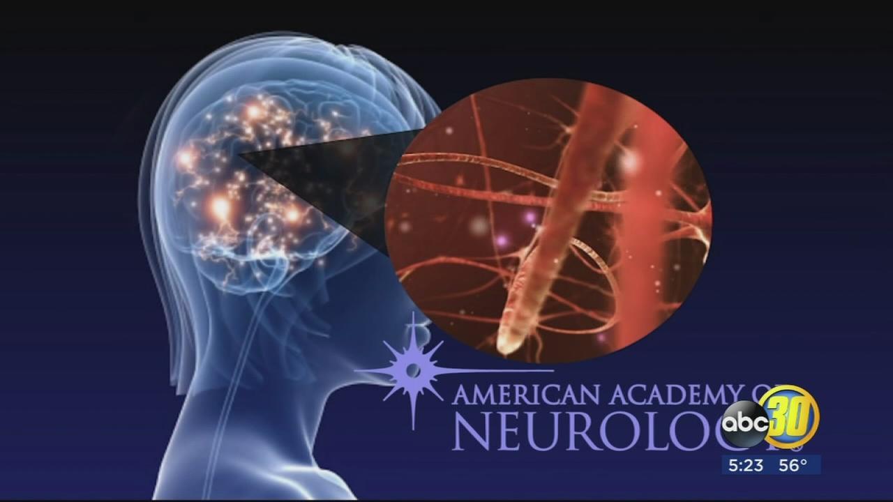 New medication shows promising results to stop progression of Multiple Sclerosis