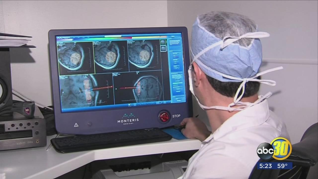 Epilepsy: 80 Seizures A Day To None!