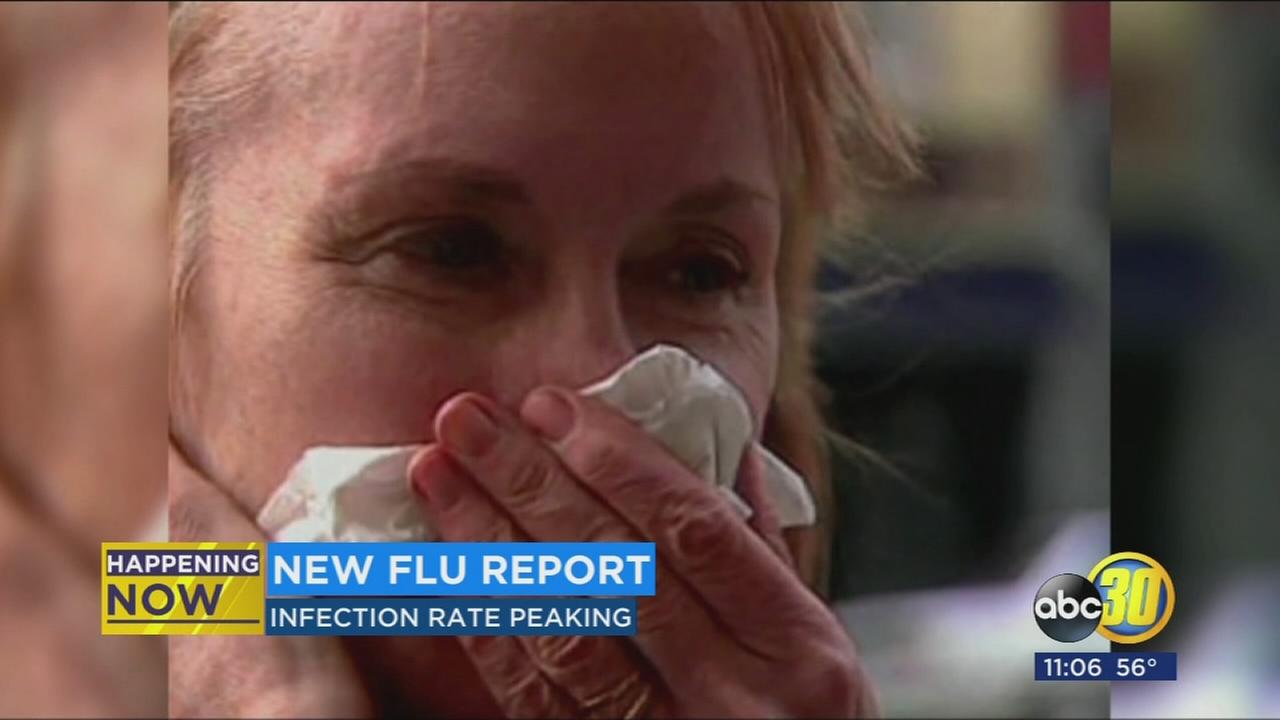 CDC says its shaping up to be a bad flu season in new report