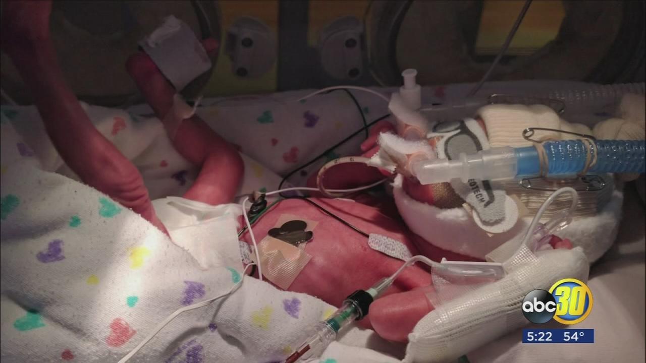 Healing power of breast milk