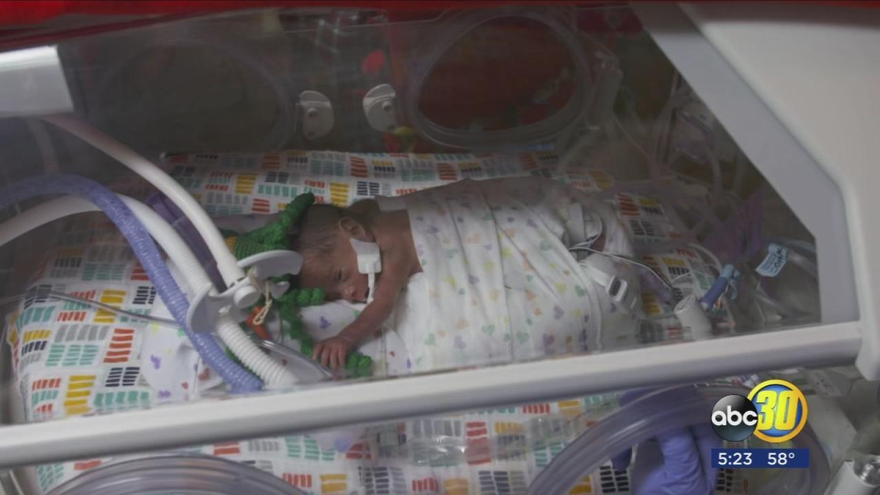 Baby octopus saves preemies