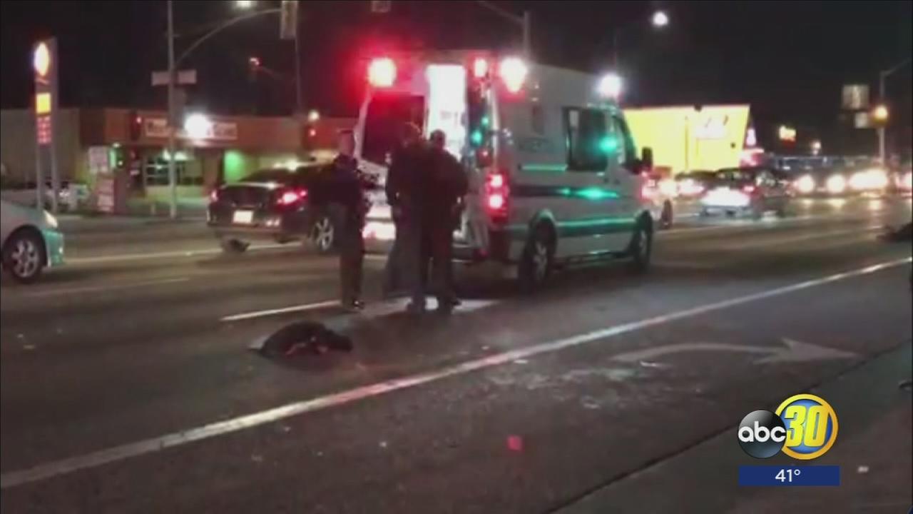 Man hospitalized after being struck by hit and run driver
