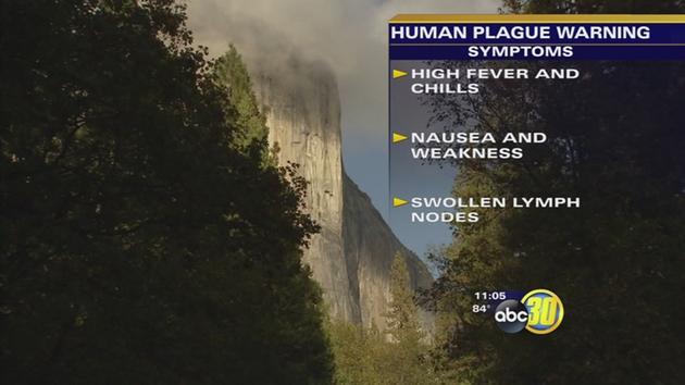 California Department of Public Health investigates case of human plague