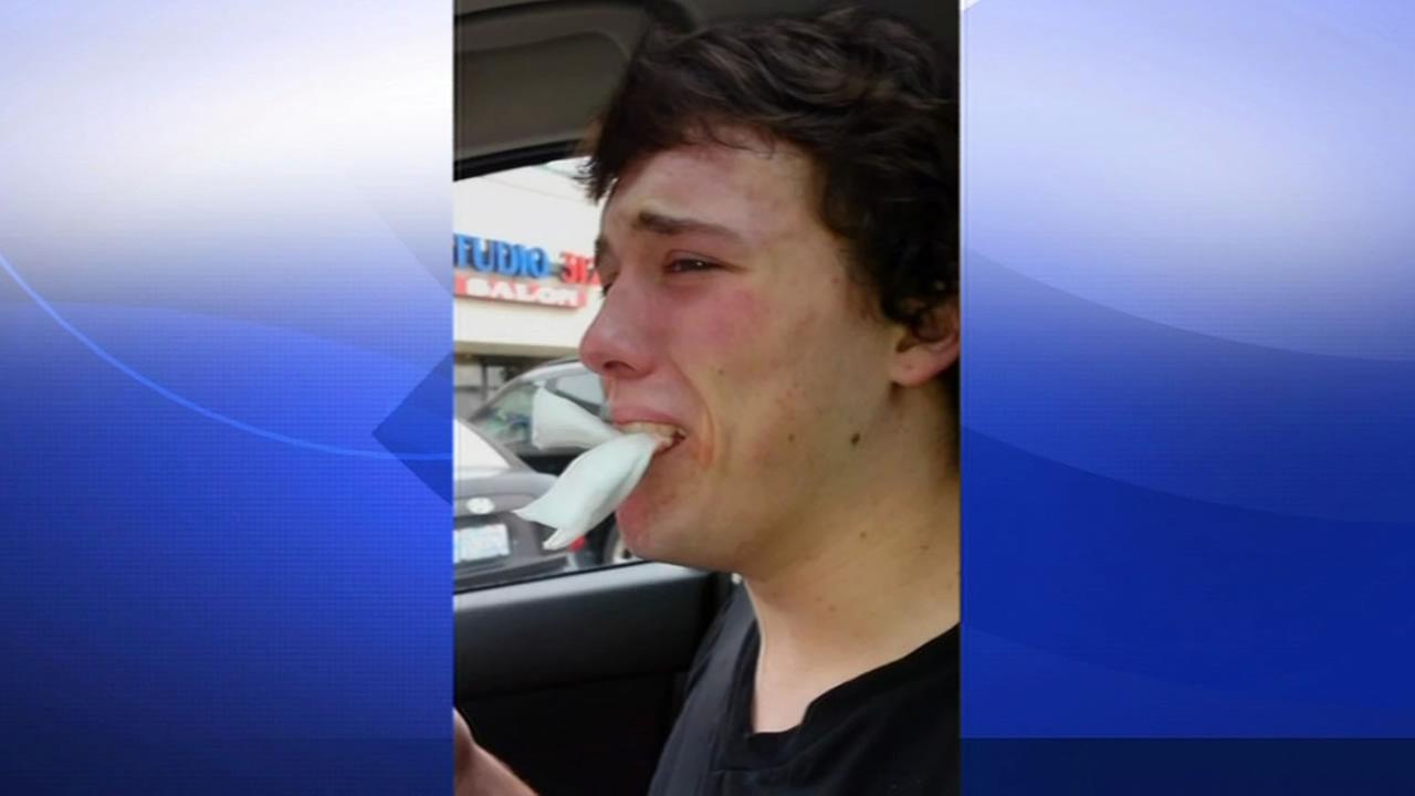 Mom has hilarious time recording son after dental surgery; son asks