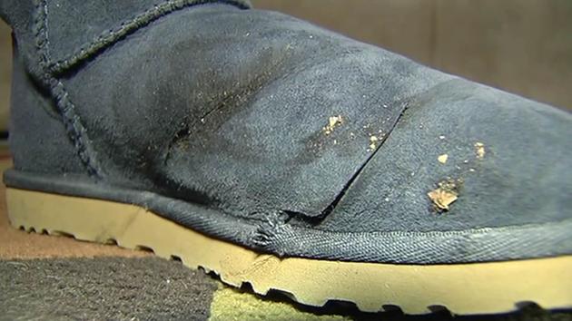 Doctors say Ugg boots may have saved 19-year-old Alyssa Padgett Gambino's foot from amputation after a car jumped a curb and drove into a Macy's in Newark on Jan. 14, 2015.