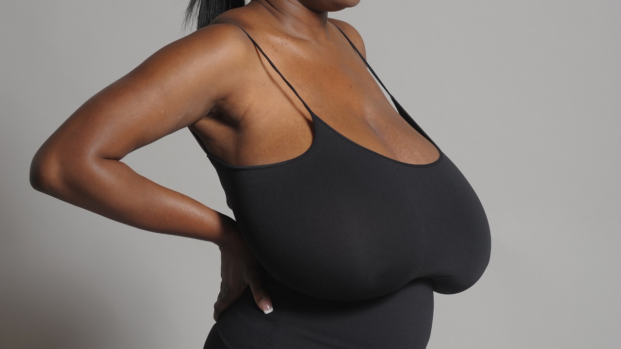 Size 36nnn Woman Undergoes Massive Breast Reduction 