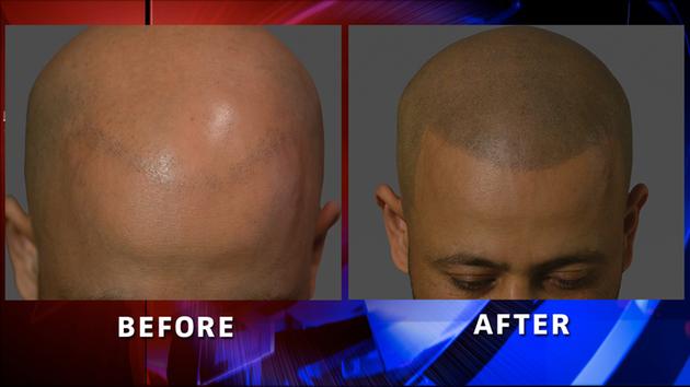 hair tattoo before and after tattoo collections hair tattoo before and after tattoo collections