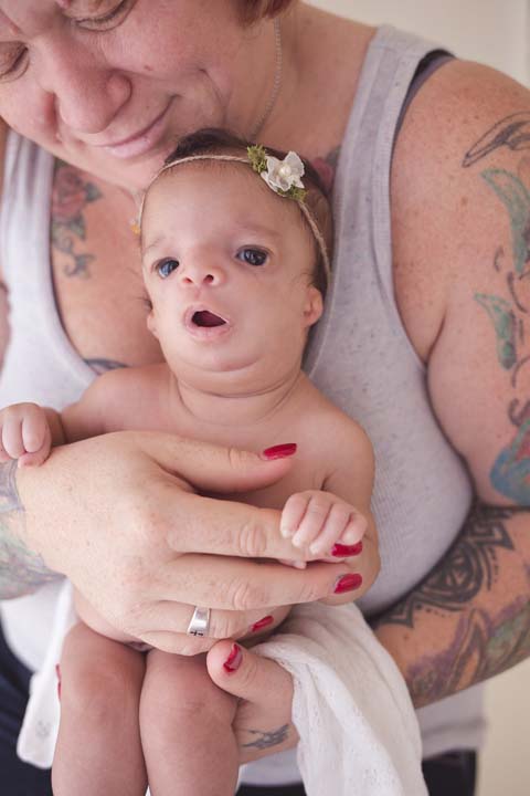 Biological mom keeps baby born with birth defects when ...