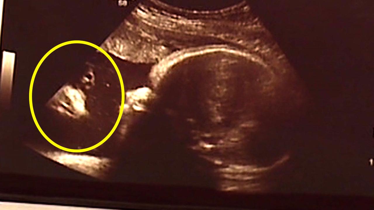 Jesus Sonogram: Couple Sees Christ in Image of Baby Girl Jesus Sonogram: Couple Sees Christ in Image of Baby Girl