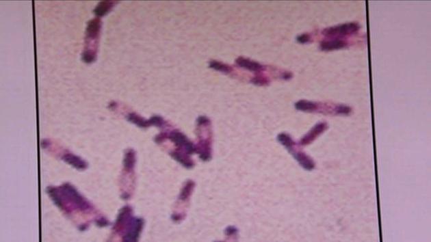 8 confirmed dead from Legionnaires' disease, 97 cases now reported in NYC