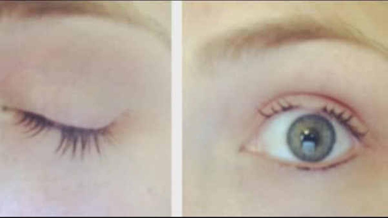 Woman claims mascara made her eyelashes fall out