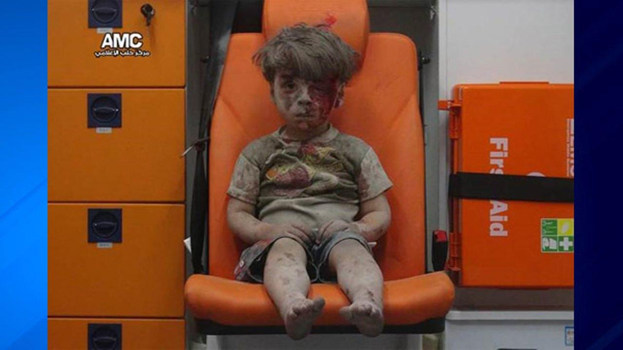 Syrian child seen bloody, dazed in heartbreaking photo taken after