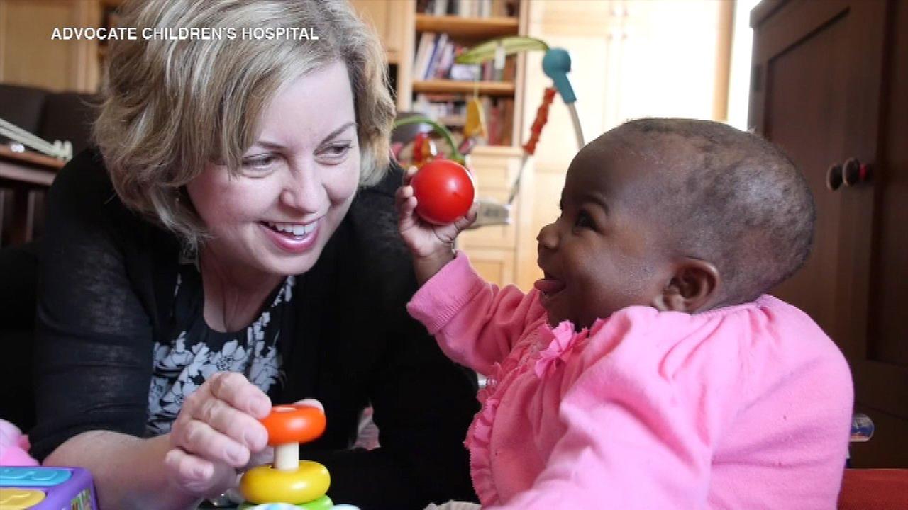 Baby born with four legs, two spines survives complex surgery in IL Baby born with four legs, two spines survives complex surgery in IL