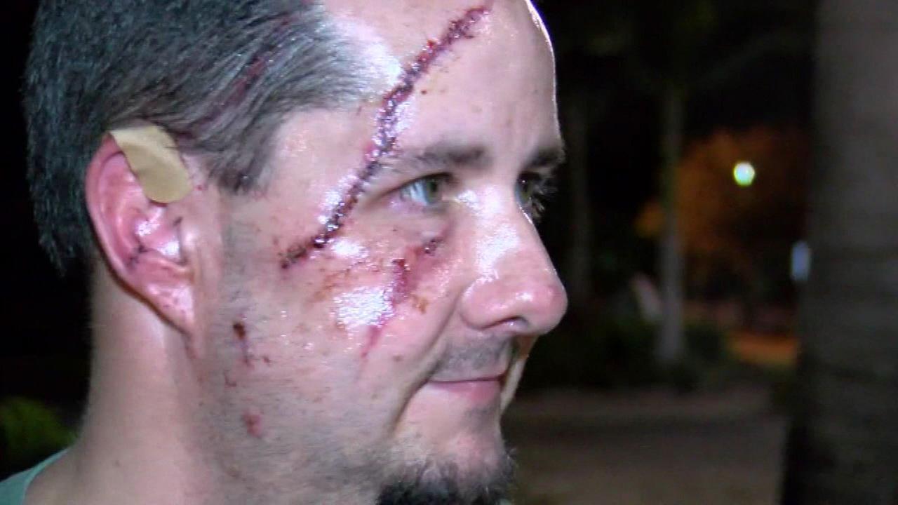Bear attacks Wisconsin man walking his dog in Florida apartment complex