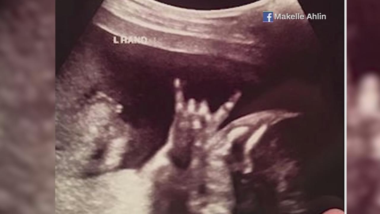 Woman who donned giraffe mask in delivery room gives birth