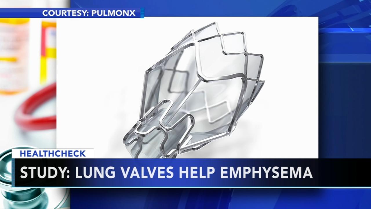 Temple reports success with lung valves for emphysema