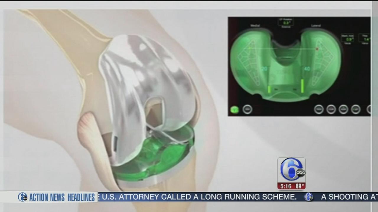 Device acts like GPS during knee replacement