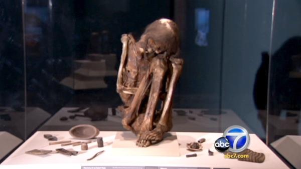 Los Angeles is finally hosting some celebrities who have a good reason for being all skin and bones.