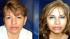 Two sisters who allegedly ran an illegal cosmetic injections business are wanted in connection with the death of a customer.