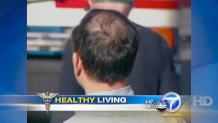 A new Annals of Oncology report suggests that men who start to go bald in their 20s may have a higher risk for prostate cancer later in life.