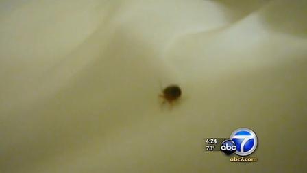 ... bed-bug bites while they were staying at a Glendale motel. (KABC Photo