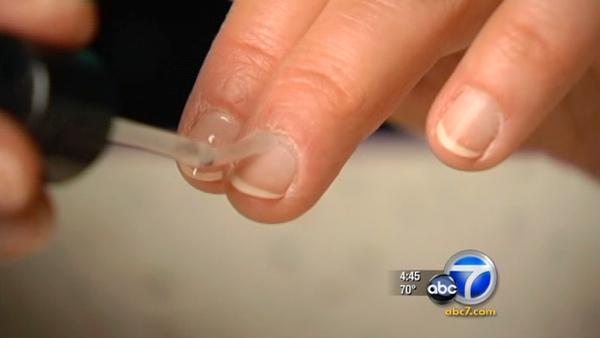 Changes in nail color could signal serious health problems