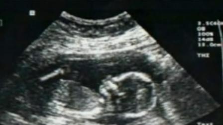 An ultrasound is shown in this undated file photo.