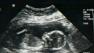 An ultrasound is shown in this undated file photo.