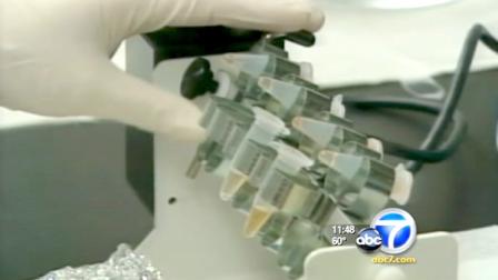 UCLA scientists released a study that vision improved in two blind women who were injected with stem cells.