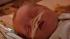 A preemie baby is seen.