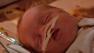 A preemie baby is seen.