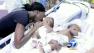 Conjoined twins separated in a marathon surgery in Memphis, Tenn., two weeks ago were doing well Wednesday.