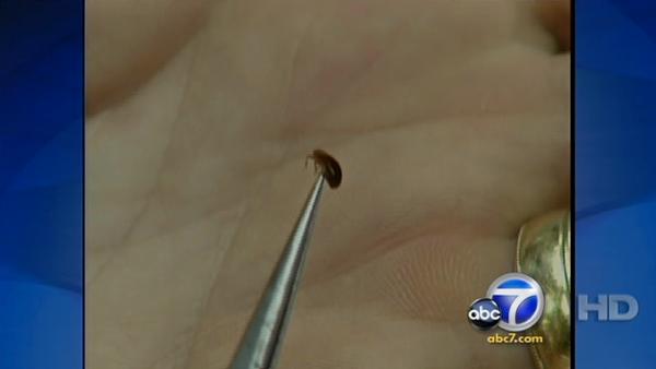 How dangerous are bed bugs?