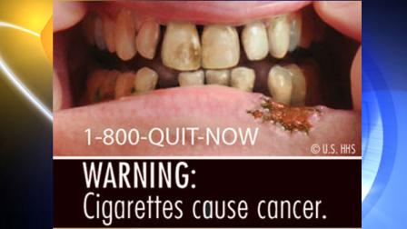 The U.S. Food and Drug Administration released nine new graphic warning labels for cigarette packs and advertisements. Cigarette makers have until fall 2012 to comply.