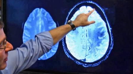 Scanned images of the brain are shown in this undated file photo.