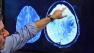 Scanned images of the brain are shown in this undated file photo.