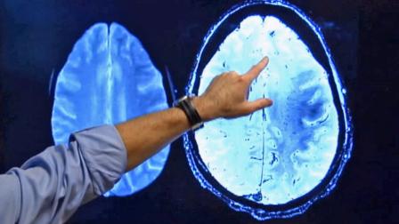 The brain is seen on a scan in this undated file photo.
