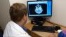 A doctor looks at a brain scan in this undated file photo.