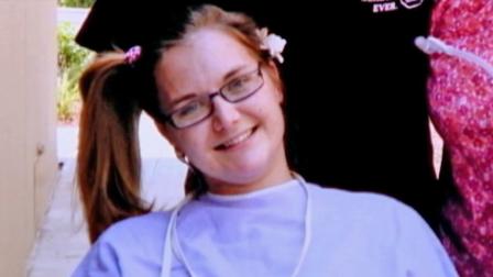 Aimee Copeland, the Georgia woman who was infected with a rare, flesh-eating disease, is seen in this undated file photo.