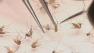 Mosquitoes are shown magnified in this file photo.