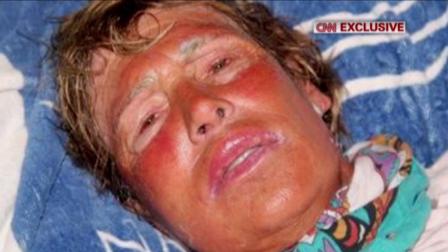 Diana Nyad, 62, is seen after being pulled from the water on Tuesday, Aug. 21, 2012.