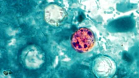 A photomicrograph of a fresh stool sample, which had been prepared using a 10% formalin solution, and stained with modified acid-fast stain, reveals the presence of four Cyclospora cayetanensis oocysts in the field of view.
