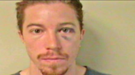 Olympic snowboarder Shaun White is seen with what appears to be a bruise under his left eye following his arrest on Sunday, Sept. 16, 2012. He was arrested for vandalism and public intoxication in Nashville, Tenn.