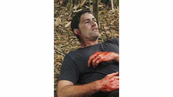 Jack Shepard (Matthew Fox) finds the bleeding part a little worrying.